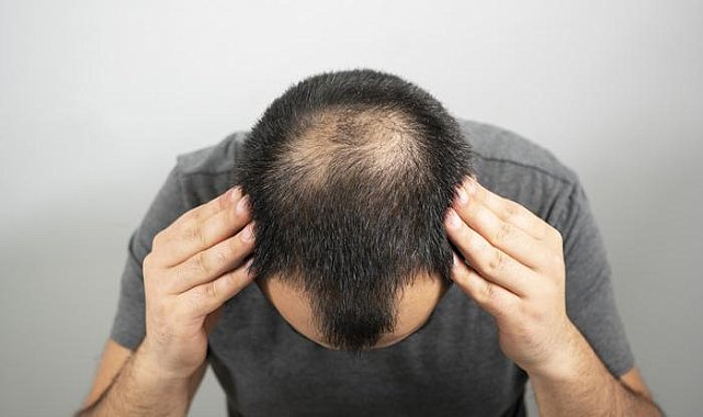 İçmeden önce bir kez daha düşünün! O içecek kelleşme riskini yüzde 42 artırıyor