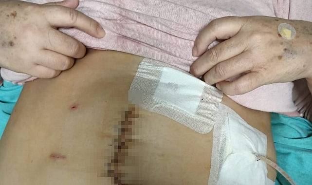 Meslekten geçici olarak men edilen doktor ile ilgili bir mağdur daha ortaya çıktı