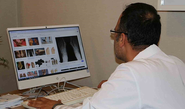 Topuklu ve sivri burun ayakkabı giymek Parmağın anatomisi bozulabilir