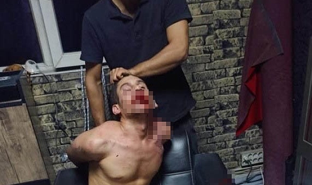 Kerpetenle dişlerini söktüler, böcek yedirip işkence yaptılar