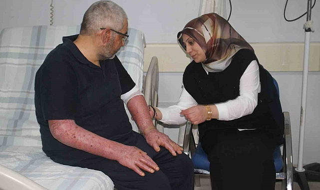 Van'da Yaşanan Patlamada Ağır Yaralanan Baba ve Oğlu, Yanık Merkezi'nde Yeniden Hayata Tutundu