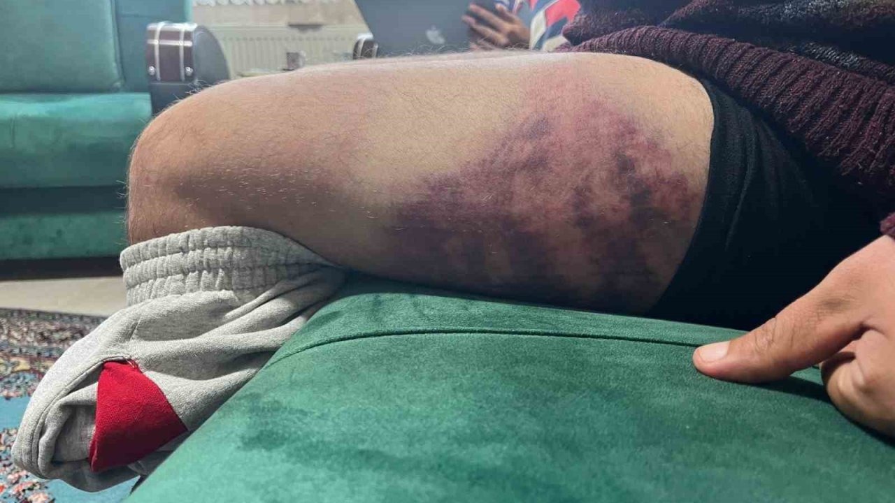 Kocaeli'de Otizmli Gence Odunlu Saldırı İddiası: Ağır Yaralandı